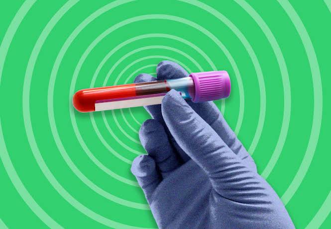 A new blood test can help detect colon cancer, but it’s not as good as the test you hate to take