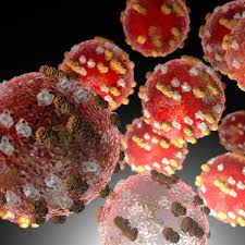 [ARCHIVED] New Cluster of Measles Cases Identified, Plus Multiple Public Exposures