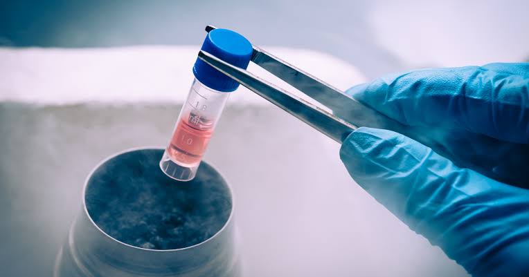 In October 2024, a team of Chinese researchers at Peking University reported that a 25-year-old woman who had lived with Type 1 diabetes since childhood stopped needing insulin injections within 75 days of receiving an experimental stem cell transplant ge
