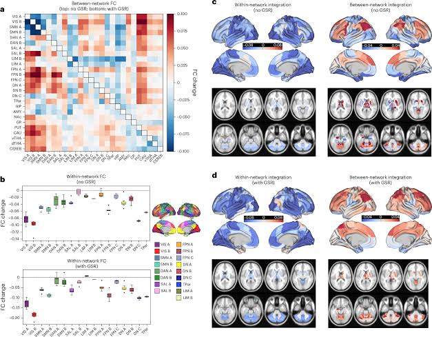 This is your brain on psychedelics: Neuroimaging study sheds light on cortical network effects