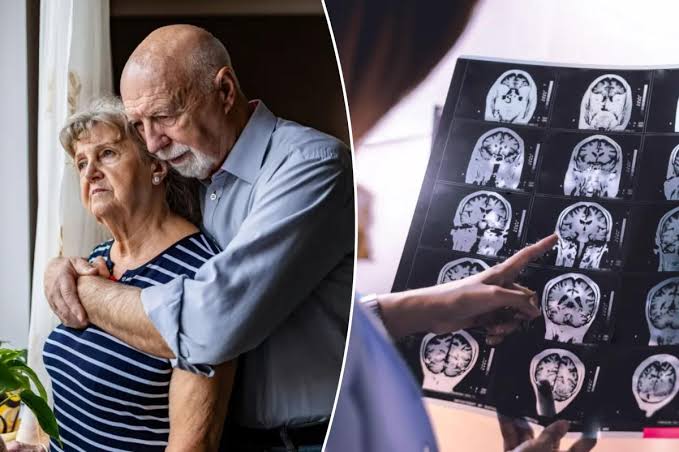 Your husband (or wife) may increase your risk of dementia by up to 70%