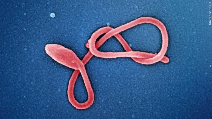 Milwaukee Health Department monitoring 3 for Ebola