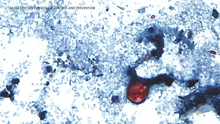 Outbreak of diarrhea caused by cyclosporiasis spreading in US with cases reported in CA, CDC says