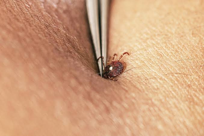 How to avoid tick bites in your yard or while hiking in the woods, and what to do if one starts feasting on you