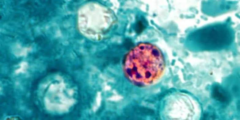 Case of cyclosporiasis confirmed in Hawaii visitor