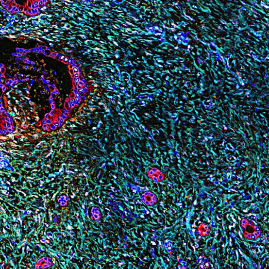 Does Revolution Medicines’ pancreatic cancer drug have even greater potential?
