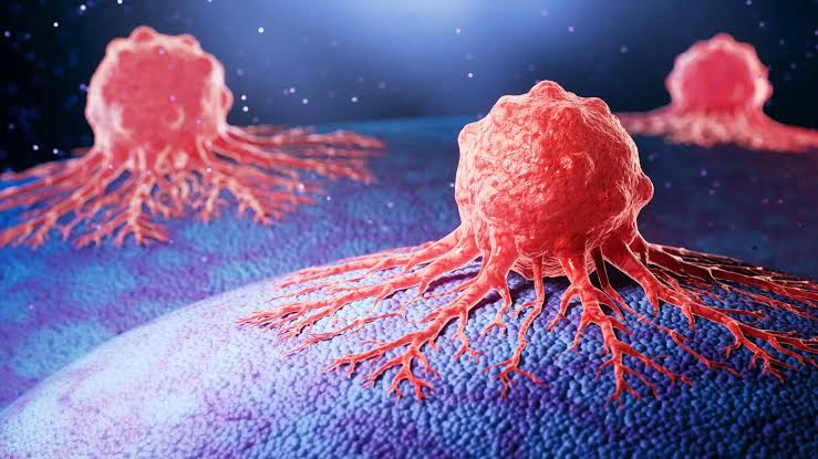 New antibody drug stops aggressive prostate cancer from spreading
