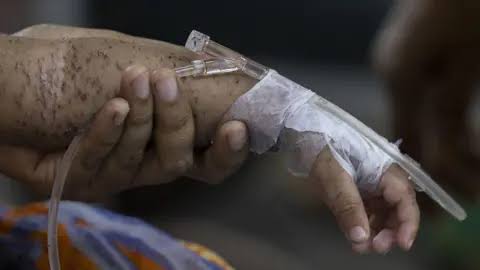 Bangladesh measles cases: Hundreds of children die within months
