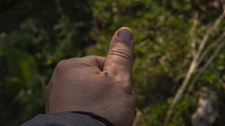 Warmer temps bring soaring tick populations. How to stay safe from Lyme disease