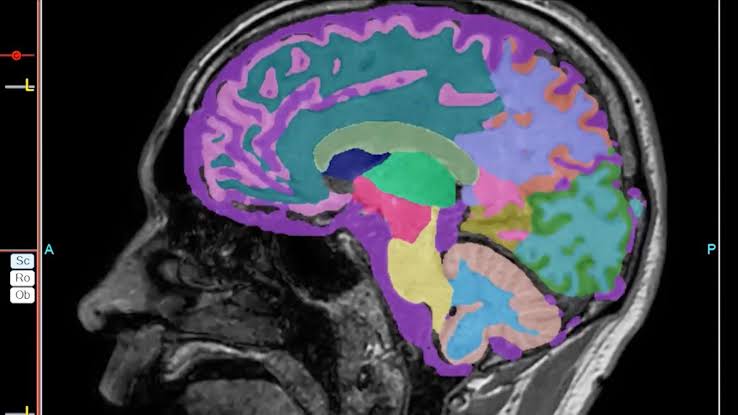 New Alzheimer’s blood test may be promising but is not yet ready for widespread use