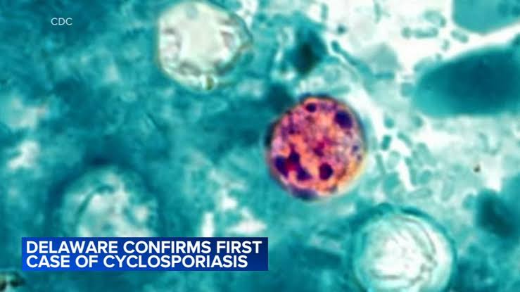 Delaware confirms first case of cyclosporiasis amid parasitic infection