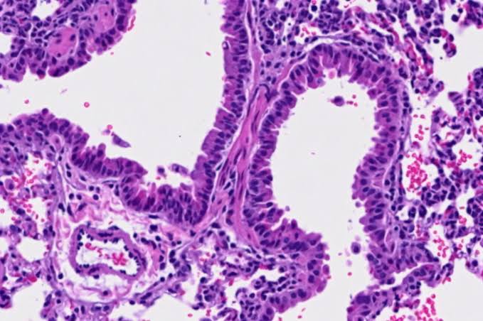 This amino acid may help the body fight tumors and viral infections