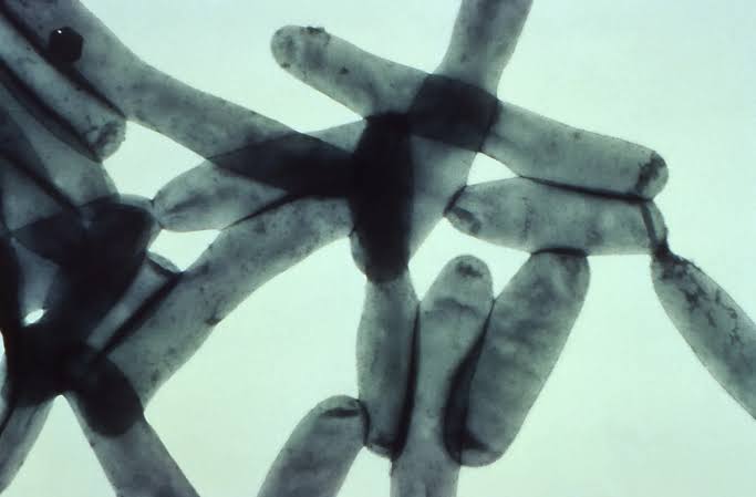 NYC Finds Legionnaires’ Bacteria in 31 Upper East Side Buildings