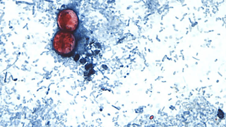 CDC: ‘Disease detectives’ to investigate cyclosporiasis cases in Ohio