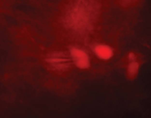 Study shows brain cells boost endurance benefits of exercise: Newsroom