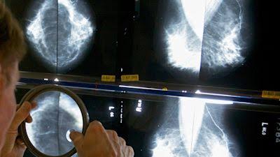 Breast cancer patient spared chemo through trial says it felt ‘like Christmas’ | ITV News