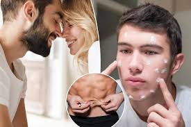 Men are taking shortcuts with a drug that ‘kills your sperm’ — and can cause acne and breast growth, warns doc