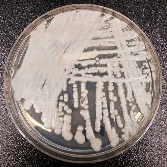 Why scientists are nervous about fungi