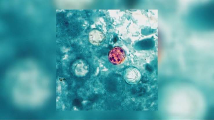 Prolonged diarrhea from parasite found commonly on produce, now in NYS
