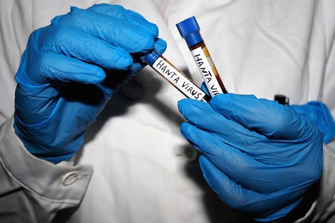 All Your Hantavirus Questions, Answered by an Infectious Disease Expert