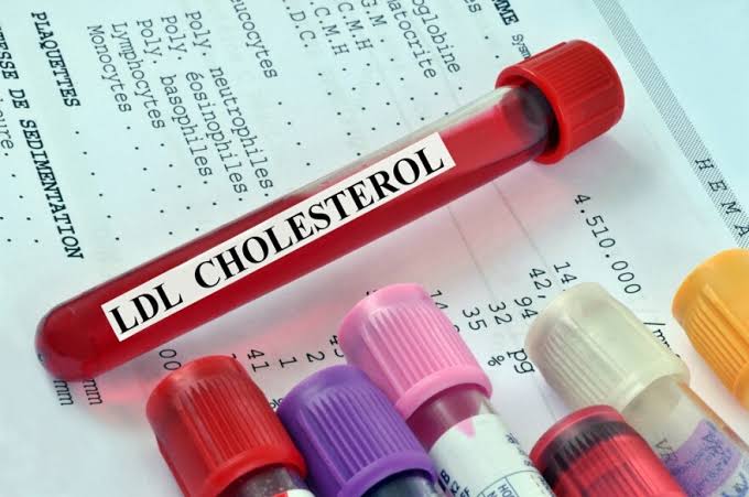 Latest cholesterol guidelines encourage doctors to check earlier for heart disease