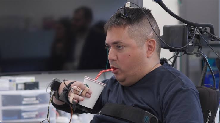 After revolutionary brain-computer implant, man with paralysis can feed himself