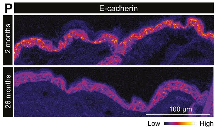 Unprecedented view inside live stem cells reveals aging process and loss of regenerative capacity
