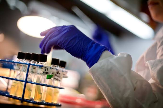 CDC pauses dozens of types of lab testing during evaluation and in wake of downsizing