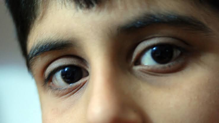Diagnostic dilemma: Doctors couldn't explain why a boy was bleeding from his eyes, ears and nose