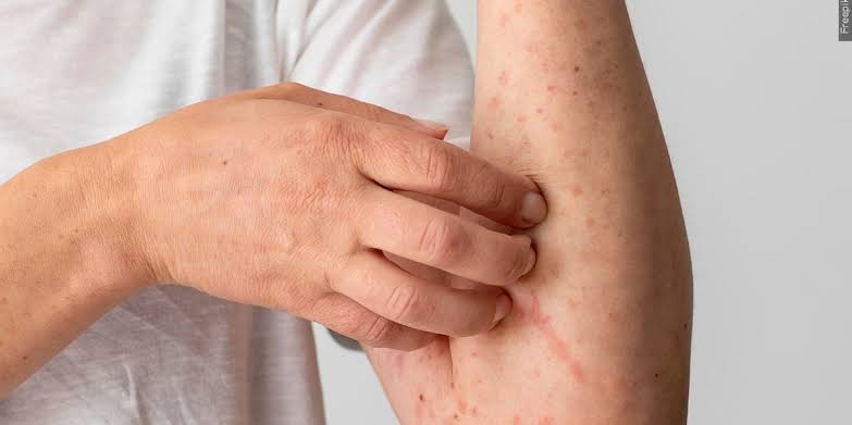 Chase Field, Chandler mall among new measles exposure sites in Maricopa County