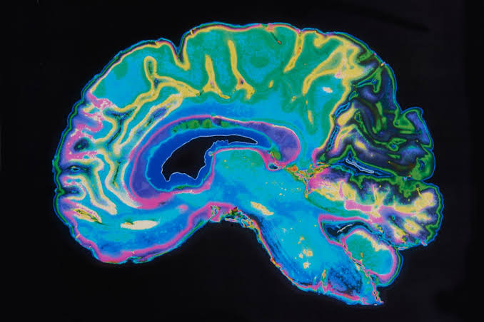 Opinion | A new study shows simple ways to avoid dementia