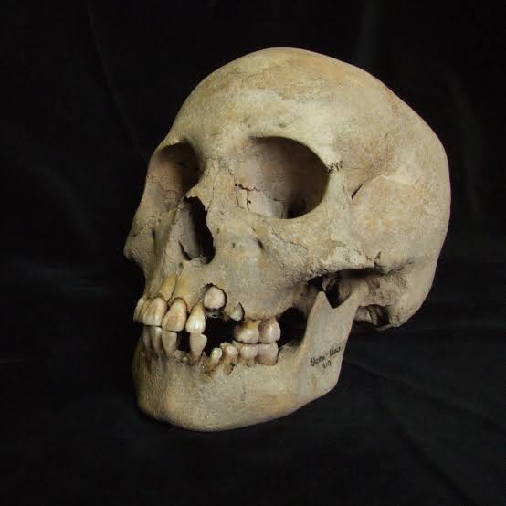 A Deadly Outbreak of Plague, Nearly 5,000 Years Before the Black Death