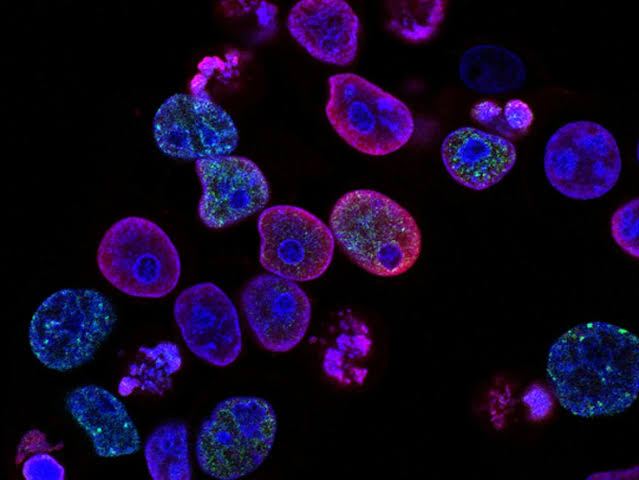 Scientists begin first trial to reverse human aging