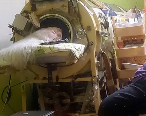 Martha Lillard, last known US polio survivor using iron lung, dies aged 78
