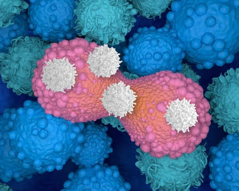 Smart drug that strips cancer cells of ‘invisibility cloak’ can shrink tumours by 30%, trial shows