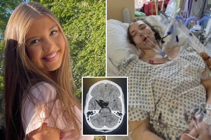 Teen’s ‘dehydration’ headaches turned out to something much more dangerous