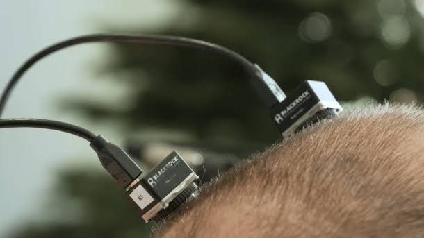 Brain-computer interface: ALS patient uses brain implant for 19 months