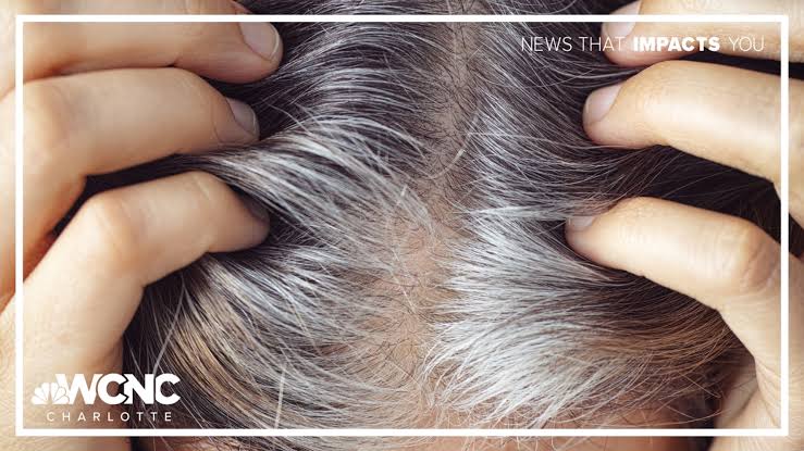 Researchers explore immunotherapy to revive natural hair color