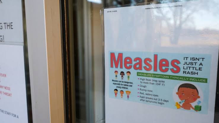 Mesa sees largest measles outbreak in decades, health officials urge vaccination