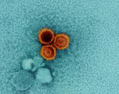 Severe COVID may awaken dormant viruses, leading to autoimmune disease, long COVID