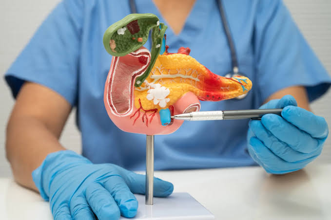 Only 13% survive this cancer. A blood test just detected 90% of early cases