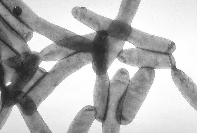UWS Building’s Hot Water System Tests Positive for Legionella Bacteria, Memo Shows
