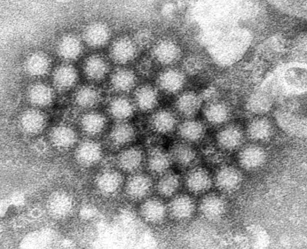 As Summer Nears, 'Winter Vomiting Disease' Surges