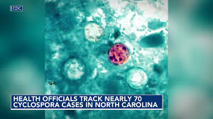 More than 60 North Carolina cases tied to parasite behind 'explosive diarrhea'