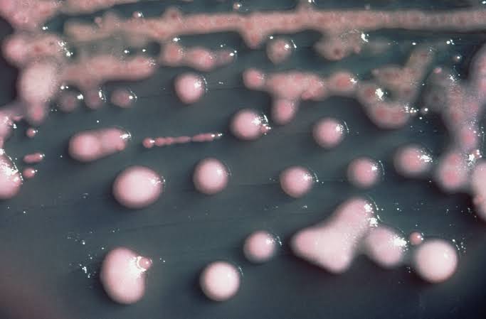 A woman got a UTI. Two years later, the bacteria had evolved, invaded her brain.