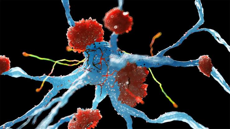 Alzheimer's Drug Review Ignites Backlash From Experts
