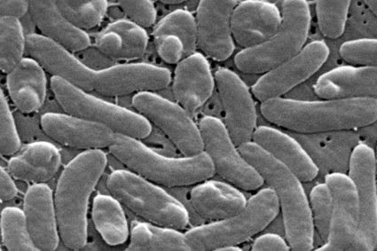Health officials urge caution for Gulf Coast beachgoers during surge of deadly bacterial infections