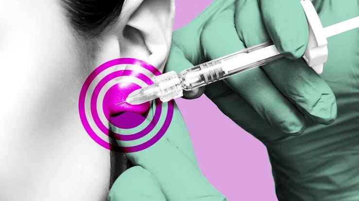 GLP-1 Users Get Surgery for 'Ozempic Ears' Side Effect