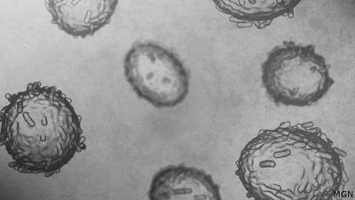 Wisconsin DHS confirms 5 mpox cases