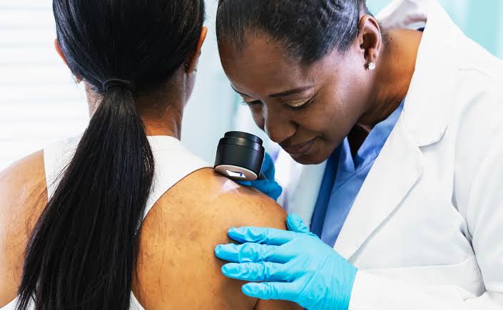 Do Altered Immune Cells Drive Skin Cancer in Immunosuppressed Patients?